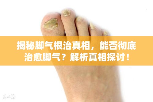 揭秘脚气根治真相，能否彻底治愈脚气？解析真相探讨！
